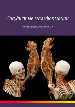 Скачать книгу Сосудистые мальформации