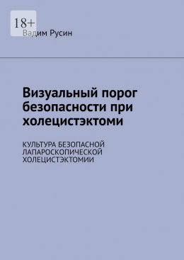 Скачать книгу Визуальный порог безопасности при холецистэктоми. Культура безопасной лапароскопической холецистэктомии