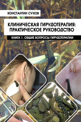 Скачать книгу Клиническая гирудотерапия: практическое руководство. Книга 1. Общие вопросы гирудотерапии