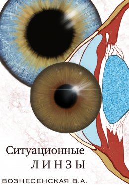 Скачать книгу Ситуационные линзы